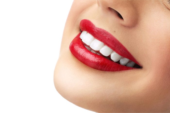 Teeth Whitening