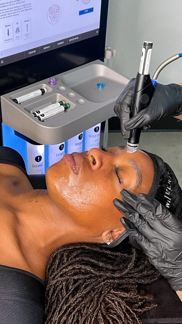 Hydrafacial® treatment being performed to deeply cleanse, exfoliate and hydrate the skin at Jenny Cader Clinic in Hertford.