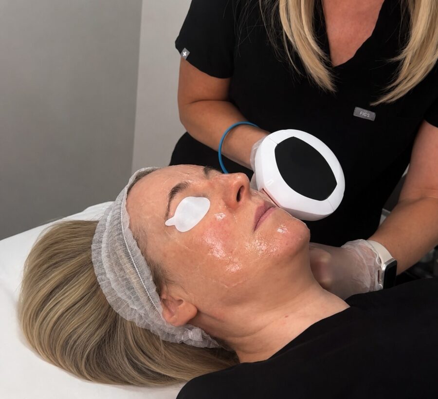 Lumecca IPL treatment reducing pigmentation and sun damage to improve skin tone at Jenny Cader Clinic, Hertford,