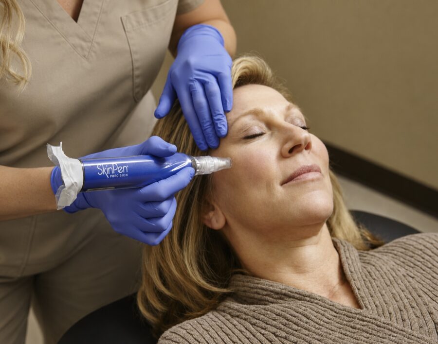 SkinPen® Precision microneedling treatment being performed to stimulate collagen production and improve skin texture at Jenny Cader Clinic.