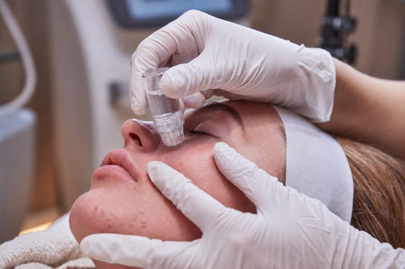 Client receiving a bespoke MesoTox treatment using precision microneedling to improve hydration, collagen production and skin quality.